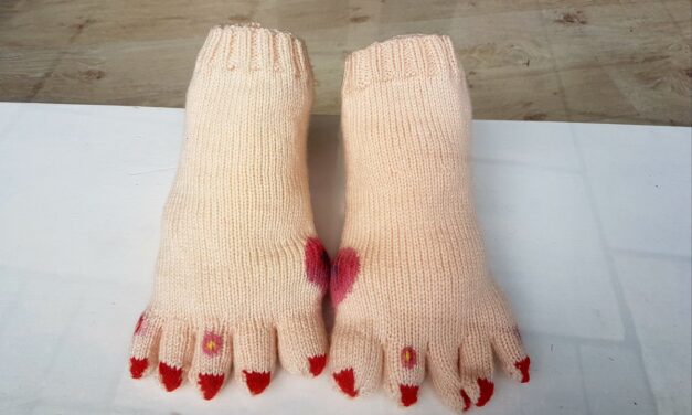 Gross! This Funny Foot Yarn Bomb is a Little Too Real … Blisters and Bunions Included!